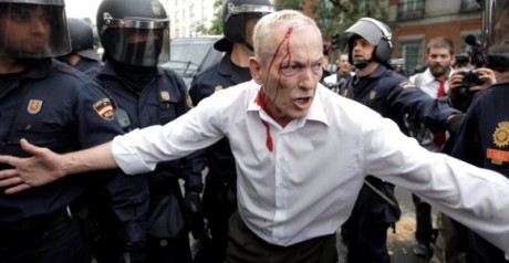 Hoy viendo el telediario de esta cadena , manifiesta que la policia se paso de la raya y actuo de manera 82