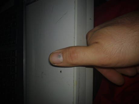 Pues si, he sido a mi, pero no os asusteis, no ha sido un tiro, ha sido una pedraa. El arma estaba descargada 00