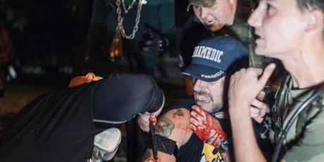A todos nos importan la vidas de los negros: "black lives matter".

¿Y las de los blancos?

Hace 20