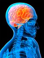 cerebro