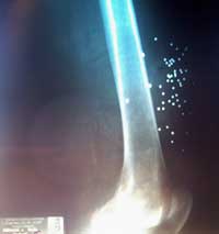 accidente_caza_1