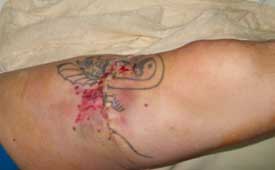 accidente_caza_3