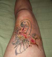 accidente_caza_4